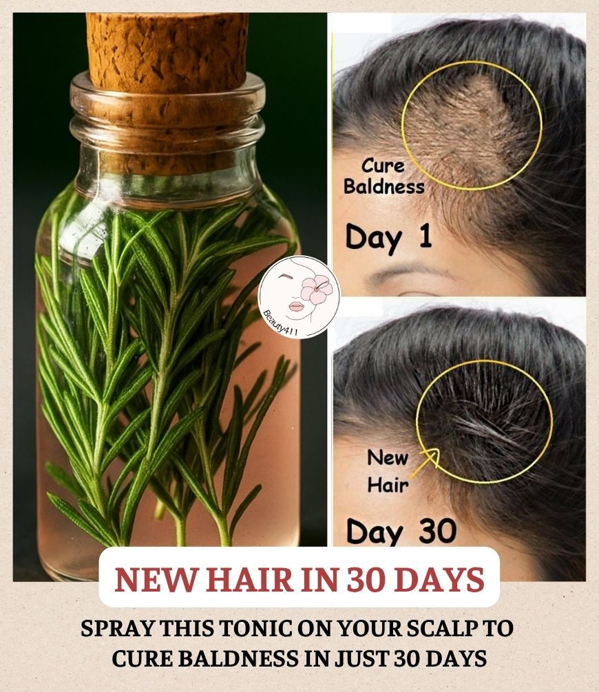 The 5 Incredible Benefits of Rosemary for Hair Growth and Health