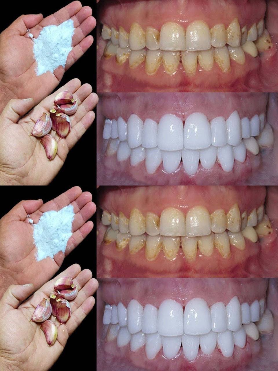 How to whiten your teeth in 2 minutes?