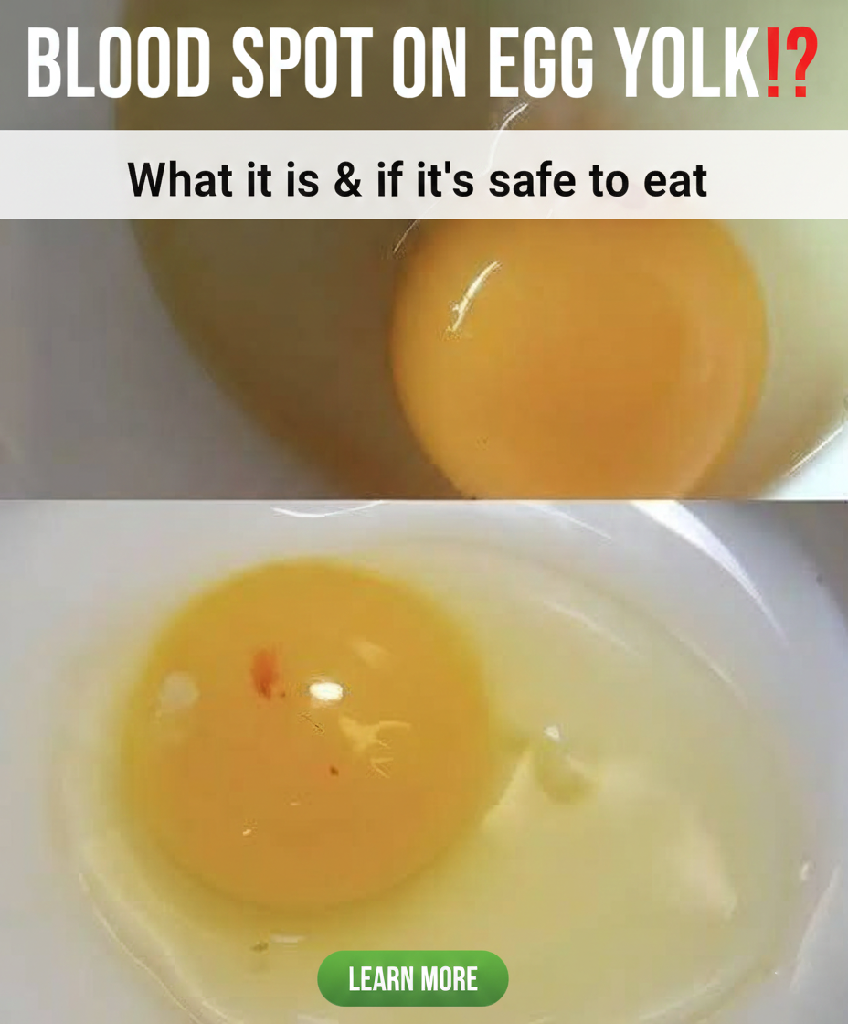 The Truth About Those Red Spots in Your Eggs: Are They Safe to Eat?