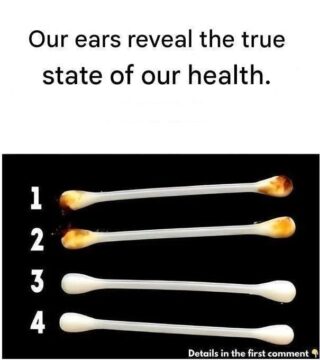 Our ears reveal our true state of health