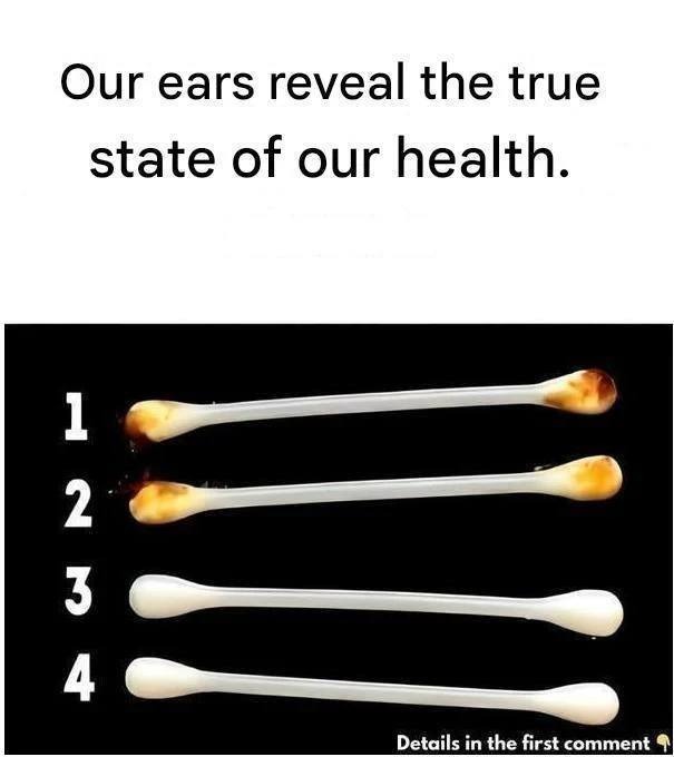 Our ears reveal our true state of health