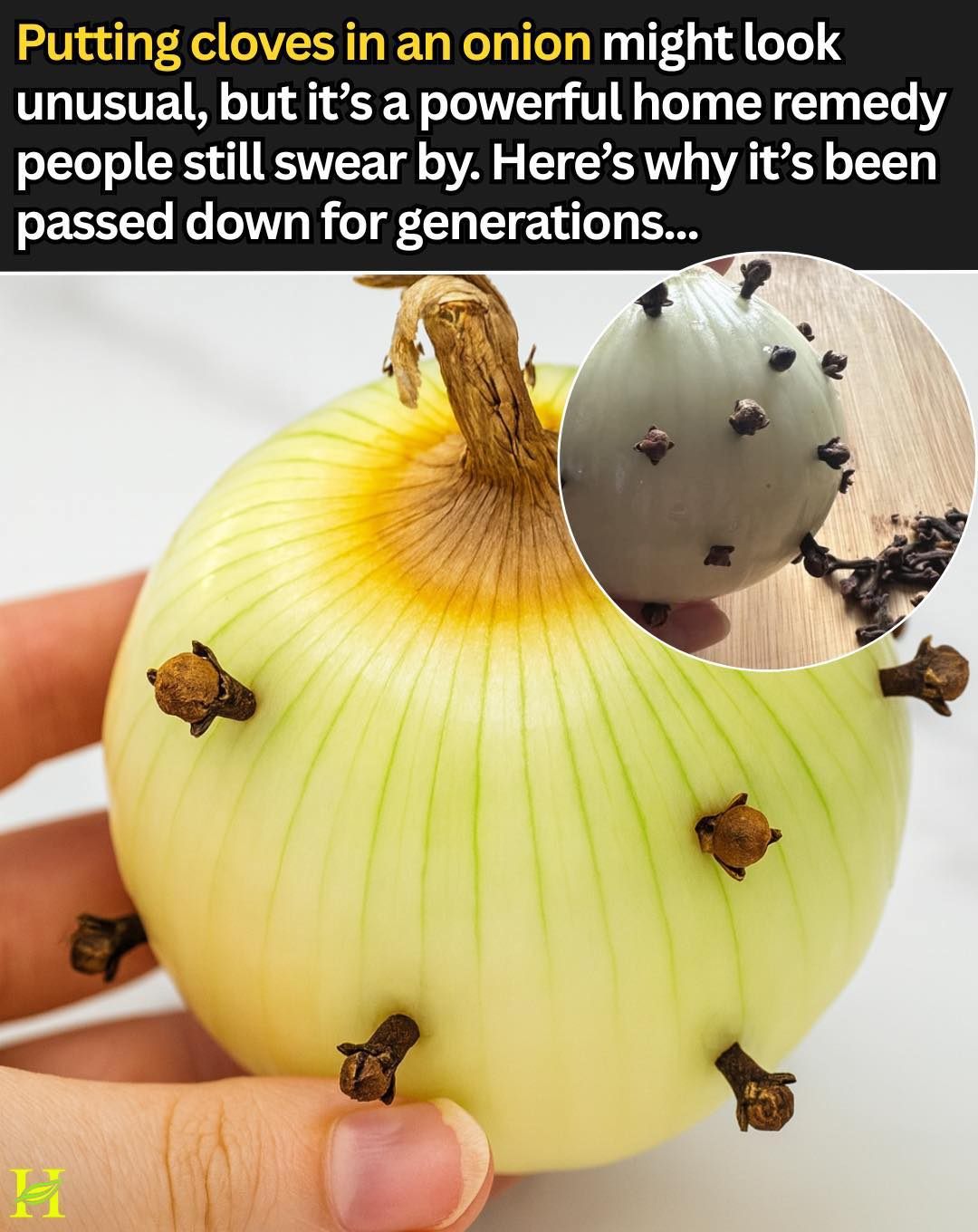 HomeBenefits of Putting Cloves in an Onion: The Powerful Home Remedy People Still Swear By Benefits of Putting Cloves in an Onion: The Powerful Home Remedy People Still Swear By