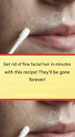 This natural recipe will permanently remove facial hair.