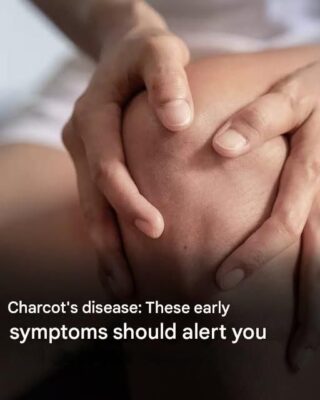 Charcot’s disease: here are the first symptoms of this condition