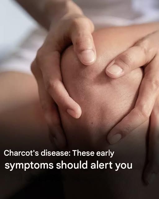 Charcot’s disease: here are the first symptoms of this condition
