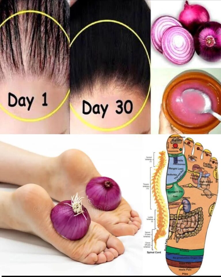 12 Ingenious Ways Onions Can Improve Your Health at Home